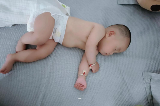 东阳宝宝脸上有白色斑块